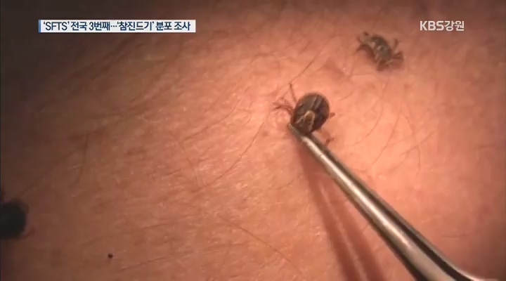 'SFTS' 전국 3번째…'참진드기' 분포 긴급 조사